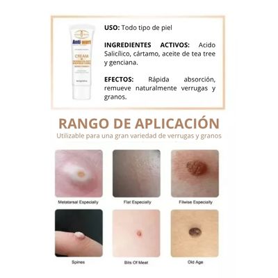 ANTI WART CREAM™ | Dí adiós a las verrugas y lunares