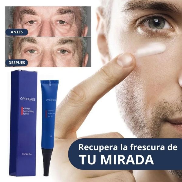 OPENEYES® | Elimina ojeras y bolsas rápida y eficazmente