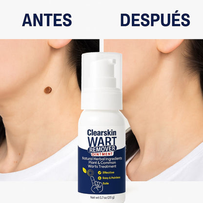 CLEARSKIN WART REMOVER™ | Di adiós a las verrugas y lunares