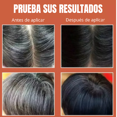 SHAMPOO ANTI CANAS DISAAR™ | Recupera el color y salud de tu pelo