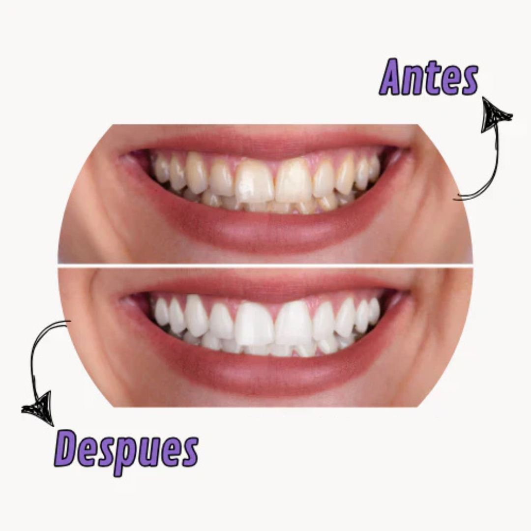 LUMEA® | Pasta dental blanqueadora